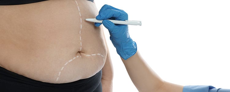 Metabolic and bariatric surgery