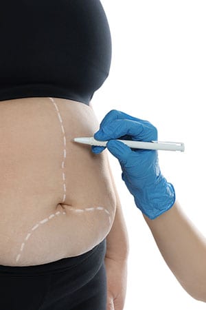 Metabolic and bariatric surgery