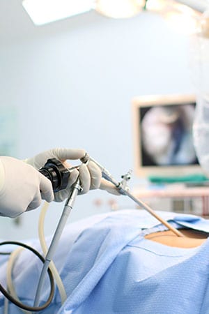 Upper gastrointestinal surgery
